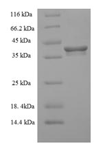 Recombinant Human ER membrane protein complex subunit 9 (EMC9) – Figure 1 of 1