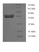 Recombinant Human Tumor necrosis factor ligand superfamily member 13B protein (TNFSF13B), partial – Figure 1 of 1