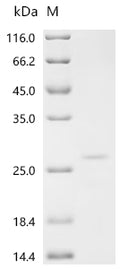 (Tris-Glycine gel) Discontinuous SDS-PAGE (reduced) with 5% enrichment gel and 15% separation gel.