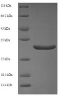 Recombinant Human Calmodulin-like protein 5 (CALML5) – Figure 1 of 1