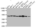 Western Blot
Positive WB detected in: Hela whole cell lysate, MCF-7 whole cell lysate, Mouse heart tissue, Mouse kidney tissue, Rat heart tissue, Rat skeletal muscle tissue, Rabbit lung tissue, Rabbit liver tissue
All lanes: ACTB antibody at 1:5000
Secondary
Goat polyclonal to mouse IgG at 1/50000 dilution
Predicted band size: 42 KDa
Observed band size: 42 KDa
Exposure time：5min