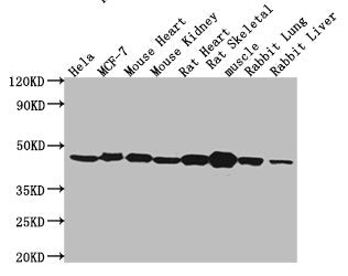 Western Blot
Positive WB detected in: Hela whole cell lysate, MCF-7 whole cell lysate, Mouse heart tissue, Mouse kidney tissue, Rat heart tissue, Rat skeletal muscle tissue, Rabbit lung tissue, Rabbit liver tissue
All lanes: ACTB antibody at 1:5000
Secondary
Goat polyclonal to mouse IgG at 1/50000 dilution
Predicted band size: 42 KDa
Observed band size: 42 KDa
Exposure time：5min