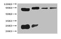All Lanes The cell supernatant hybridoma of Sumo tag
Lane 1 Sumo tagged fusion protein at 20ng
Lane 2 Sumo tagged fusion protein at 2ng
Lane 3 Sumo tagged fusion protein at 0.2ng
Lane 4 Sumo tagged fusion protein at 0.02ng
Secondary
Goat polyclonal to Rabbit IgG at 1/15000 dilution
Predicted band size : 50kd
Observed band size: 50kd
Additional bands at : 25 kd