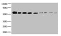 WB:SUMO-tagged fusion protein(20ng/ml) was subjected to SDS-PAGE followed by Western Blot with CSB-MA000132M0m at dilution of
Lane 1:1000  Lane 4:8000   Lane 7:64000
Lane 2:2000  Lane 5:16000  Lane 8:128000
Lane 3:4000  Lane 6:32000  Lane 9:256000
Secondary
Goat polyclonal to Mouse IgG at 1/5000 dilution
Predicted band size:55kd
Observed band size:55kd