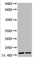 Western blot analysis of Hela, diluted at 1) 1:2000 2) 1:5000