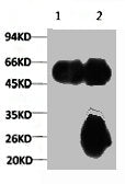 1) Input: Mouse Brain Tissue Lysate  2) IP product: IP dilute 1:200