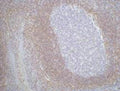 BCL2 Monoclonal Antibody – Figure 1 of 2