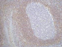 BCL2 Monoclonal Antibody – Figure 1 of 2