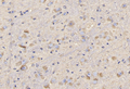 CD4 Monoclonal Antibody – Figure 1 of 1