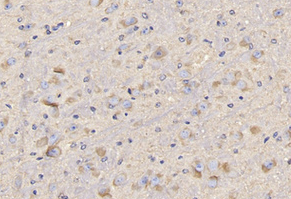 CD4 Monoclonal Antibody – Figure 1 of 1