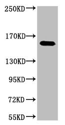 ERBB2 Monoclonal Antibody – Figure 1 of 1