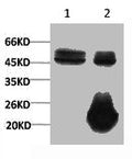 1) Input: Hela Cell Lysate  2) IP product: IP dilute 1:200