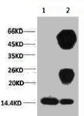 1) Input: Hela Cell Lysate  2) IP product: IP dilute 1:200