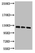 Western blot analysis of 1) Hela, 2) 293T, 3) Jurkat, diluted at 1:2000.