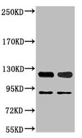 Western blot analysis of 1) Jurkat, 2) Hela, diluted at 1:2000.