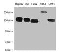 Western Blot
Positive WB detected in: HepG2 whole cell lysate, 293 whole cell lysate, Hela whole cell lysate, SY5Y whole cell lysate, U251 whole cell lysate 
All lanes: ABCB1 antibody at 1:1000
Secondary
Goat polyclonal to mouse IgG at 1/50000 dilution
Predicted band size: 141 kDa
Observed band size: 141-250 KDa
Exposure time：5min