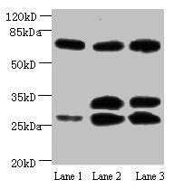 Western blot
All lanes: Amyloid beta A4 antibody at 1µg/ml
Lane 1: Mouse heart tissue
Lane 2: Mouse kidney tissue
Lane 3: Mouse lung tissue
Secondary
Goat polyclonal to Mouse IgG at 1/15000 dilution
Predicted band size: 30, 35, 72, 80 kDa
Observed band size: 30, 35, 72 kDa