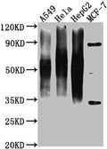 Western Blot
Positive WB detected in: A549 whole cell lysate, Hela whole cell lysate, HepG2 whole cell lysate, MCF-7 whole cell lysate 
All lanes CD63 antibody at 1:1000
Secondary
Goat polyclonal to mouse IgG at 1/50000 dilution
Predicted band size: 30-120 KD KDa
Observed band size: 30-120 KD KDa
Exposure time：1min