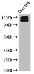 Western Blot
Positive WB detected in: Caco205 whole cell lysate
All lanes: CDH1 antibody at 1:1000
Secondary
Goat polyclonal to Mouse IgG at 1/10000 dilution
Predicted band size: 98, 91 kDa
Observed band size: 110, 120 kDa