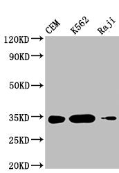 Western Blot
Positive WB detected in: CEM whole cell lysate, K562 whole cell lysate, Raji whole cell lysate 
All lanes: CTLA4 antibody at 1:1000
Secondary
Goat polyclonal to mouse IgG at 1/50000 dilution
Predicted band size: 25, 7, 9, 20 KDa
Observed band size: 34 KDa
Exposure time：5min