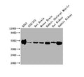 Western Blot
Positive WB detected in: K562 whole cell lysate, NIH/3T3 whole cell lysate, Rat Brain tissue, Mouse Brain tissue, Rabbit Skeletal Muscle tissue, Rat Kidney tissue, Rabbit Kidney tissue 
All lanes ENO1 antibody at 1:10000
Secondary
Goat polyclonal to mouse IgG at 0.261ug/ml
Predicted band size: 47 KDa
Observed band size: 47 KDa
Exposure time: 1min