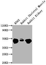 Western Blot
Positive WB detected in: K562 whole cell lysate, Rabbit Skeletal Muscle tissue, Rabbit Kidney lysate
All lanes ENO1 antibody at 1:10000
Secondary
Goat polyclonal to mouse IgG at 0.261ug/ml
Predicted band size: 47 KDa
Observed band size: 47 KDa
Exposure time: 1min