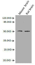 Western Blot
Positive WB detected in: Mouse brain tissue, Rat brain tissue
All lanes: GFAP antibody at 2.7µg/ml
Secondary
Goat polyclonal to Mouse IgG at 1/10000 dilution
Predicted band size: 50, 51 kDa
Observed band size: 50 kDa