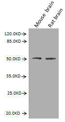 Western Blot
Positive WB detected in: Mouse brain tissue, Rat brain tissue
All lanes: GFAP antibody at 2.7µg/ml
Secondary
Goat polyclonal to Mouse IgG at 1/10000 dilution
Predicted band size: 50, 51 kDa
Observed band size: 50 kDa