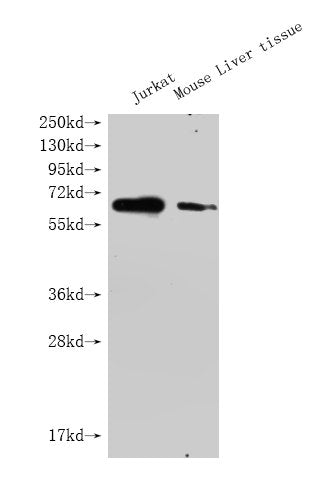 Western Blot Positive WB detected in: GPC3 antibody at 1:1000 Lane 1: Jurkat whole cell lysate Lane 2: Mouse liver tissue Secondary Goat polyclonal to Mouse IgG at 1/20000 dilution Predicted band size: 65-70KDa Observed band size: 65-70 KDa Exposure time: 5min