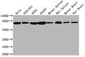 Western Blot
Positive WB detected in: Hela whole cell lysate, NIH/3T3 whole cell lysate, K562 whole cell lysate, HepG2 whole cell lysate, Mouse spleen tissue, Rat spleen tissue, Mouse heart tissue, Rat heart tissue 
All lanes HSPA8 antibody at 1:2000
Secondary
Goat polyclonal to mouse IgG at 1/50000 dilution
Predicted band size: 70~75 KDa
Observed band size: 70~75 KDa
Exposure time: 10s