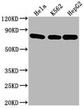 Western Blot
Positive WB detected in: Hela whole cell lysate, K562 whole cell lysate, HepG2 whole cell lysate
All lanes HSPA8 antibody at 1:2000
Secondary
Goat polyclonal to mouse IgG at 1/50000 dilution
Predicted band size: 70~75 KDa
Observed band size: 70~75 KDa
Exposure time: 5min