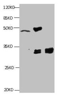 All lanes:Mouse anti-Human Cyfra21-1(KS19.1) monoclonal antibody at 4ug/ml
Lane 1: MCF7 cell lysate
Lane2: MDA-MB-231 cell lysate
Lane3: HepG-2 cell lysate
Secondary HRP labeled Goat polyclonal to Mouse IgG at 1/3000 dilution
Predicted band size : 30 kDa
Observed band size : 32 kDa
Additional bands at: 50kd