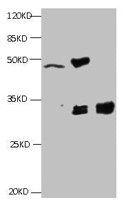 All lanes:Mouse anti-Human Cyfra21-1(KS19.1) monoclonal antibody at 4ug/ml
Lane 1: MCF7 cell lysate
Lane2: MDA-MB-231 cell lysate
Lane3: HepG-2 cell lysate
Secondary HRP labeled Goat polyclonal to Mouse IgG at 1/3000 dilution
Predicted band size : 30 kDa
Observed band size : 32 kDa
Additional bands at: 50kd