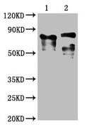 Western Blot
Positive WB detected in: 1 lane: Recombinant proteins with LAG3; 2 lane: 293F whole cell lysate transfected with LAG3 
All lanes: LAG3 antibody at 1:2000
Secondary
Goat polyclonal to mouse IgG at 1/50000 dilution
Predicted band size: 76, 88 KDa
Observed band size: 76, 88 KDa
Exposure time：5min