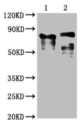 Western Blot
Positive WB detected in: 1 lane: Recombinant proteins with LAG3; 2 lane: 293F whole cell lysate transfected with LAG3 
All lanes: LAG3 antibody at 1:2000
Secondary
Goat polyclonal to mouse IgG at 1/50000 dilution
Predicted band size: 76, 88 KDa
Observed band size: 76, 88 KDa
Exposure time：5min