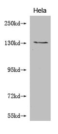 Western Blot
Positive WB detected in: Hela whole cell lysate 
All lanes: NOS2 antibody at 1:2000
Secondary
Goat polyclonal to mouse IgG at 1/50000 dilution
Predicted band size: 131, 127 kDa
Observed band size: 131 KDa
Exposure time：5min