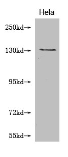 Western Blot
Positive WB detected in: Hela whole cell lysate 
All lanes: NOS2 antibody at 1:2000
Secondary
Goat polyclonal to mouse IgG at 1/50000 dilution
Predicted band size: 131, 127 kDa
Observed band size: 131 KDa
Exposure time：5min