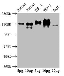 Western Blot
Positive WB detected in: Jurkat whole cell lysate, THP-1 whole cell lysate, Raji whole cell lysate
All lanes: CD31 antibody at 2.5µg/ml
Secondary
Goat polyclonal to Mouse IgG at 1/50000 dilution
Predicted band size: 83, 81, 80, 82 kDa
Observed band size: 130 kDa