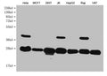 Western Blot
Positive WB detected in: Hela whole cell lysate, MCF7 whole cell lysate, 293T whole cell lysate, JK whole cell lysate, HepG2 whole cell lysate, Raji whole cell lysate, U87 whole cell lysate 
All lanes: PRDX3 antibody at 1:1000
Secondary
Goat polyclonal to mouse IgG at 1/50000 dilution
Predicted band size: 28 kDa
Observed band size: 28 KDa
Exposure time：5min