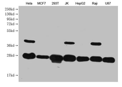 Western Blot
Positive WB detected in: Hela whole cell lysate, MCF7 whole cell lysate, 293T whole cell lysate, JK whole cell lysate, HepG2 whole cell lysate, Raji whole cell lysate, U87 whole cell lysate 
All lanes: PRDX3 antibody at 1:1000
Secondary
Goat polyclonal to mouse IgG at 1/50000 dilution
Predicted band size: 28 kDa
Observed band size: 28 KDa
Exposure time：5min