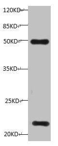 All lanes:Mouse anti-Human Timp1 monoclonal antibody at 1ug/ml
Lane 1: HepG-2 cell lysate
Predicted band size : 23 kDa
Observed band size : 23 kDa
Additional bands at:50KD