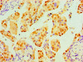 TP53 Monoclonal Antibody – Figure 1 of 4