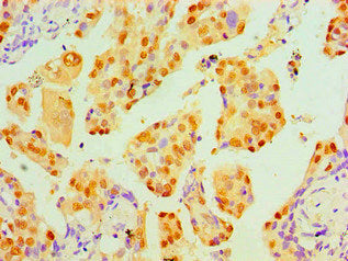 TP53 Monoclonal Antibody – Figure 1 of 4