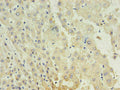 Immunohistochemistry of paraffin-embedded human liver using CSB-MA027711A0m in 30ug/ml dilute concentrations.