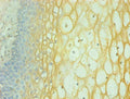 Immunohistochemical of paraffin-embedded human cervical using CSB-MA065241A0m at dilution of 1:200