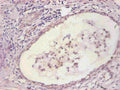 Immunohistochemical of paraffin-embedded human prostate tissue using CSB-MA067571A0m at dilution of 1:200