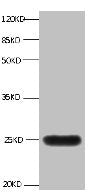 All lanes:Mouse anti-human Neutrophil gelatinase-associated lipocalin monoclonal antibody at 1ug/ml
Lane 1:NGAL transfected 293 cell lysate
Predicted band size : 22 kDa
Observed band size : 25 kDa