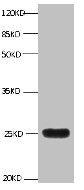 All lanes:Mouse anti-human Neutrophil gelatinase-associated lipocalin monoclonal antibody at 1ug/ml
Lane 1:NGAL transfected 293 cell lysate
Predicted band size : 22 kDa
Observed band size : 25 kDa