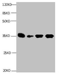 All lanes: Mouse anti- Human Insulin-like growth factor-binding protein 1 monoclonal antibody at 1ug/ml
Lane 1:Pyrolysis liquid human placental tissue 7.5ug/ml
Lane 2:Pyrolysis liquid human placental tissue 3.25ug/ml
Lane 3:IGFBP1 transfected SF9 cell lysate
Lane 4:human amniotic fluid
Secondary Goat polyclonal to Mouse IgG at 1/5000 dilution
Predicted band size : 28kd
Observed band size : 35kd