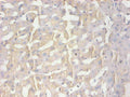 Immunohistochemical of paraffin-embedded human liver tissue using CSB-MA100091A0m at dilution of 1:200